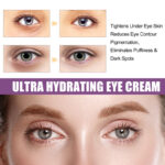 EELHOE Eye Cream – Lighten Eye Bags, Dark Circles, and Revitalize Your Eyes